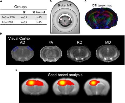 Spontaneous Brain Activity Did Not Show the Effect of Violent