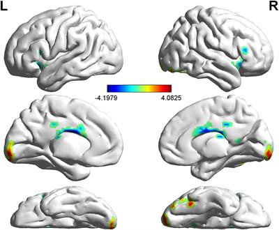 Spontaneous Brain Activity Did Not Show the Effect of Violent