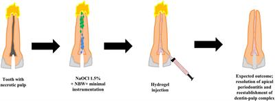 Regenerative Endodontics and Minimally Invasive Dentistry: Intertwining Paths Crossing Over Into Clinical Translation