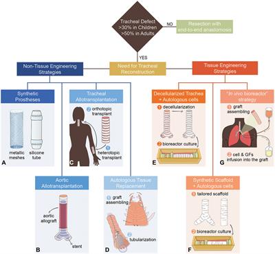 The Growing Medical Need for Tracheal Replacement: Reconstructive Strategies Should Overcome Their Limits