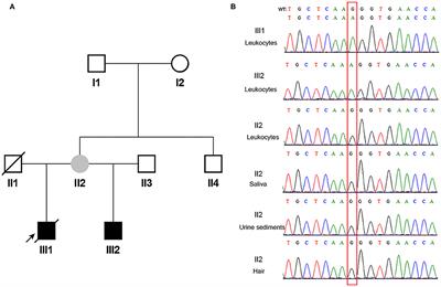 Frontiers  Case Report: Low-Level Maternal Mosaicism of a Novel CREBBP  Variant Causes Recurrent Rubinstein-Taybi Syndrome in Two Siblings of a  Chinese Family