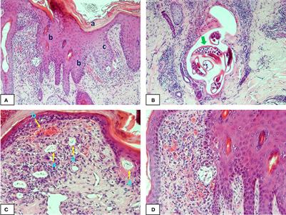 Frontiers | Pathology and pathogenesis of cutaneous lesions in beef ...