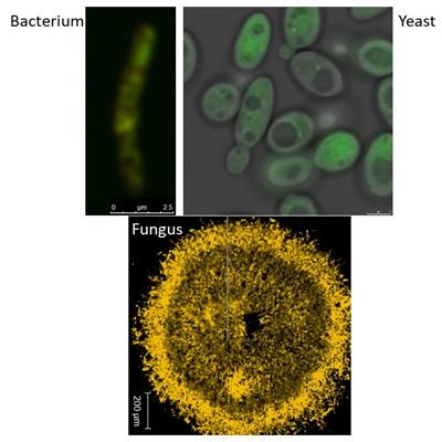 Microorganisms Harmful Microorganisms: