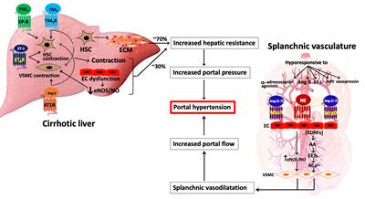 portal hypertension